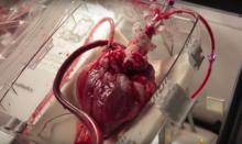 გამაოგნებელი გამოგონება, რომელიც გულს ამუშავებს ადამიანის ორგანიზმის გარეშე