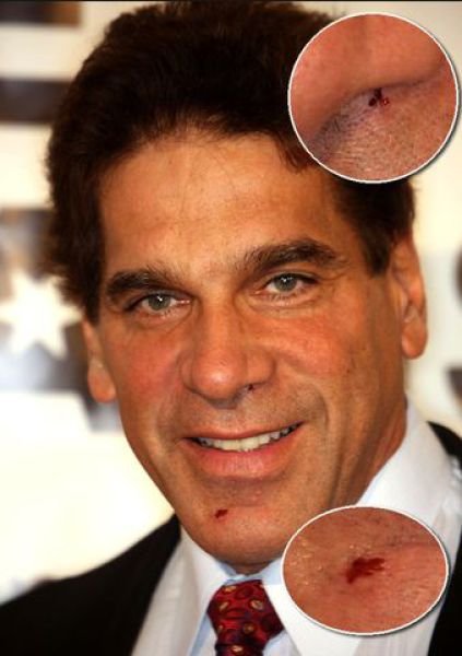 ლუ ფერინო / Lou Ferrigno