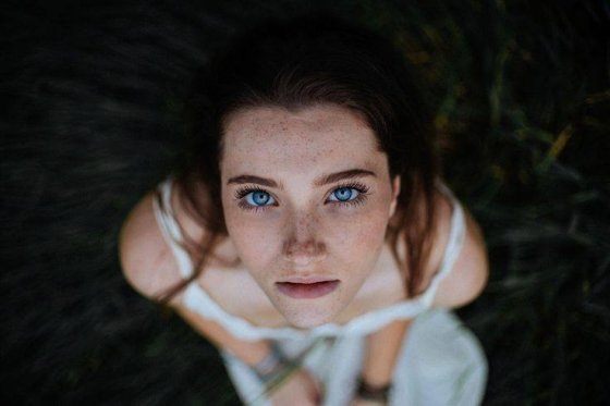 ჭორფლიანი გლამური
